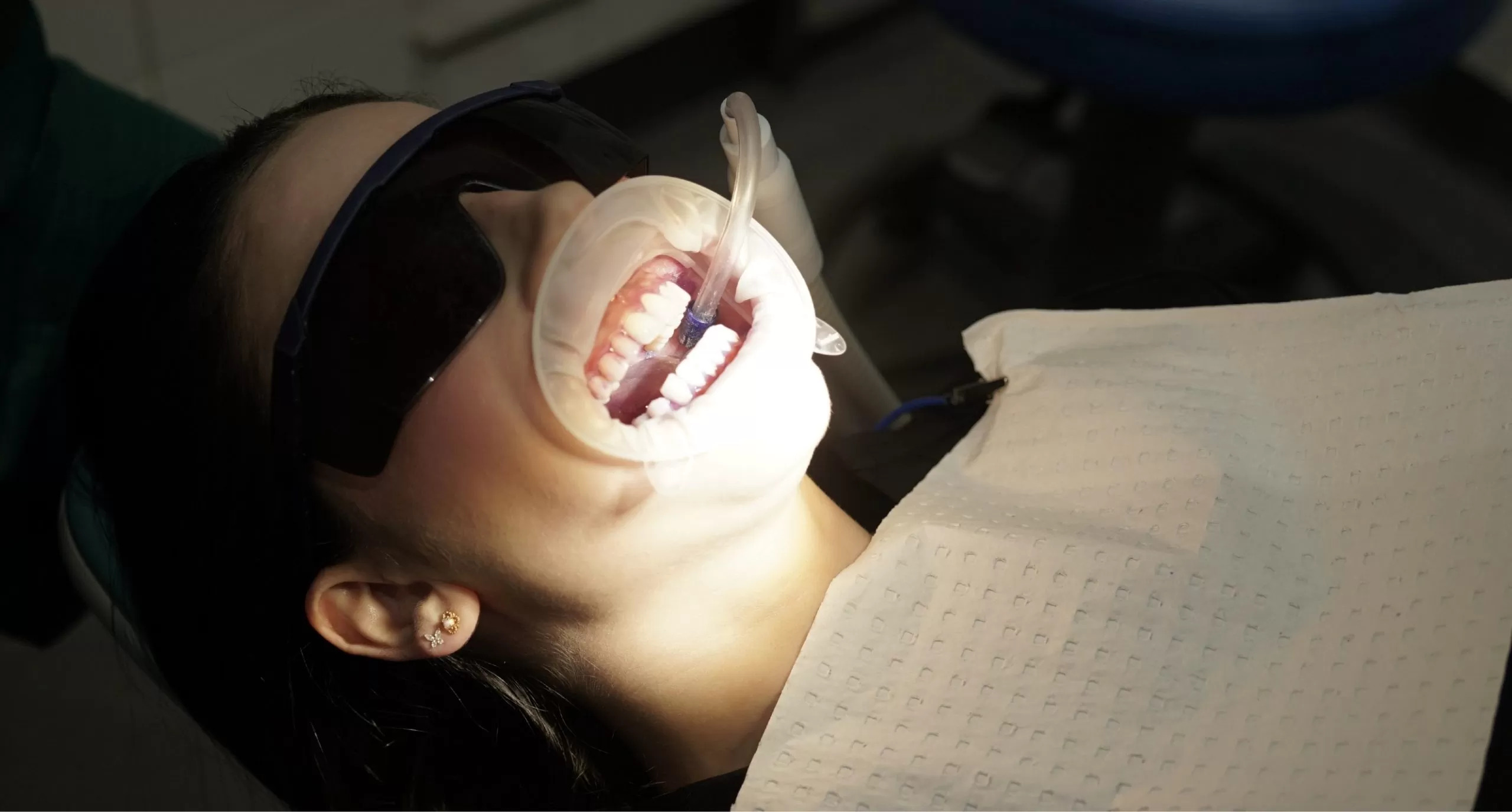 Dentist Check Up and Clean | TLC Dentist